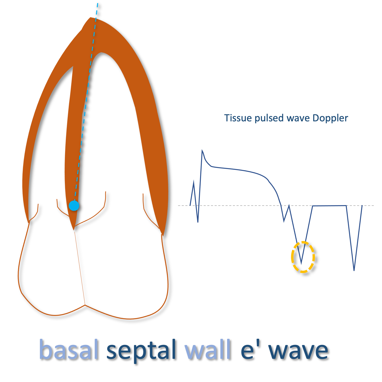 septal e