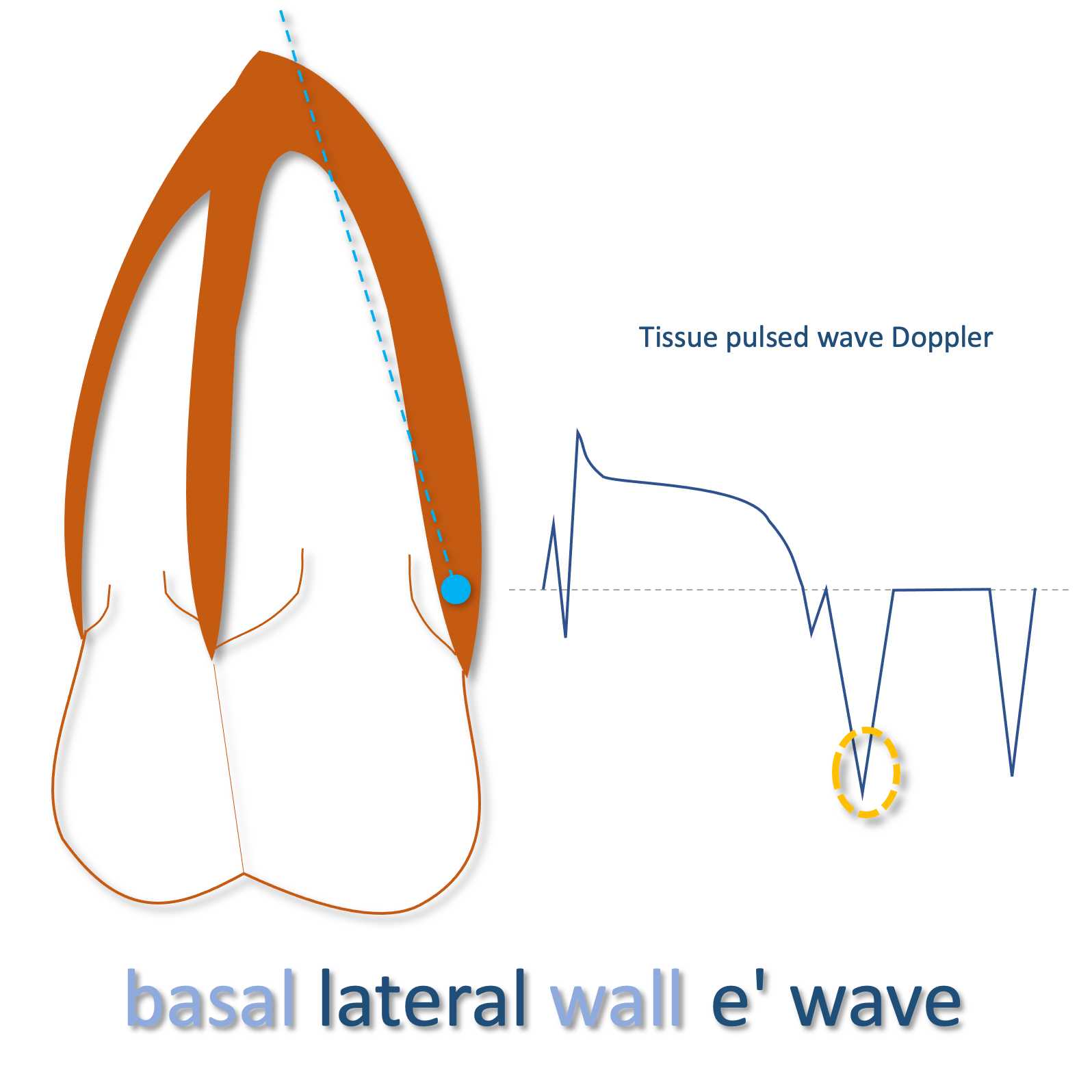 lateral e'